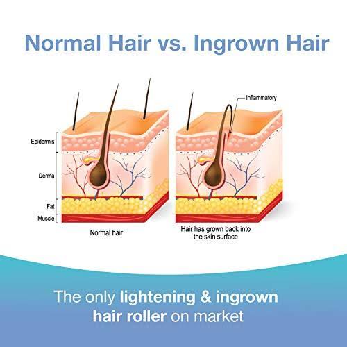 Dark Spot Remover Skin Care Treatment U286575